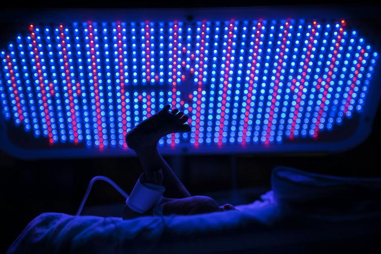 A newborn's tiny foot silhouetted against a phototherapy light grid