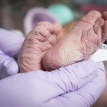 A baby in the JPS Health Network NICU in Fort Worth, Texas